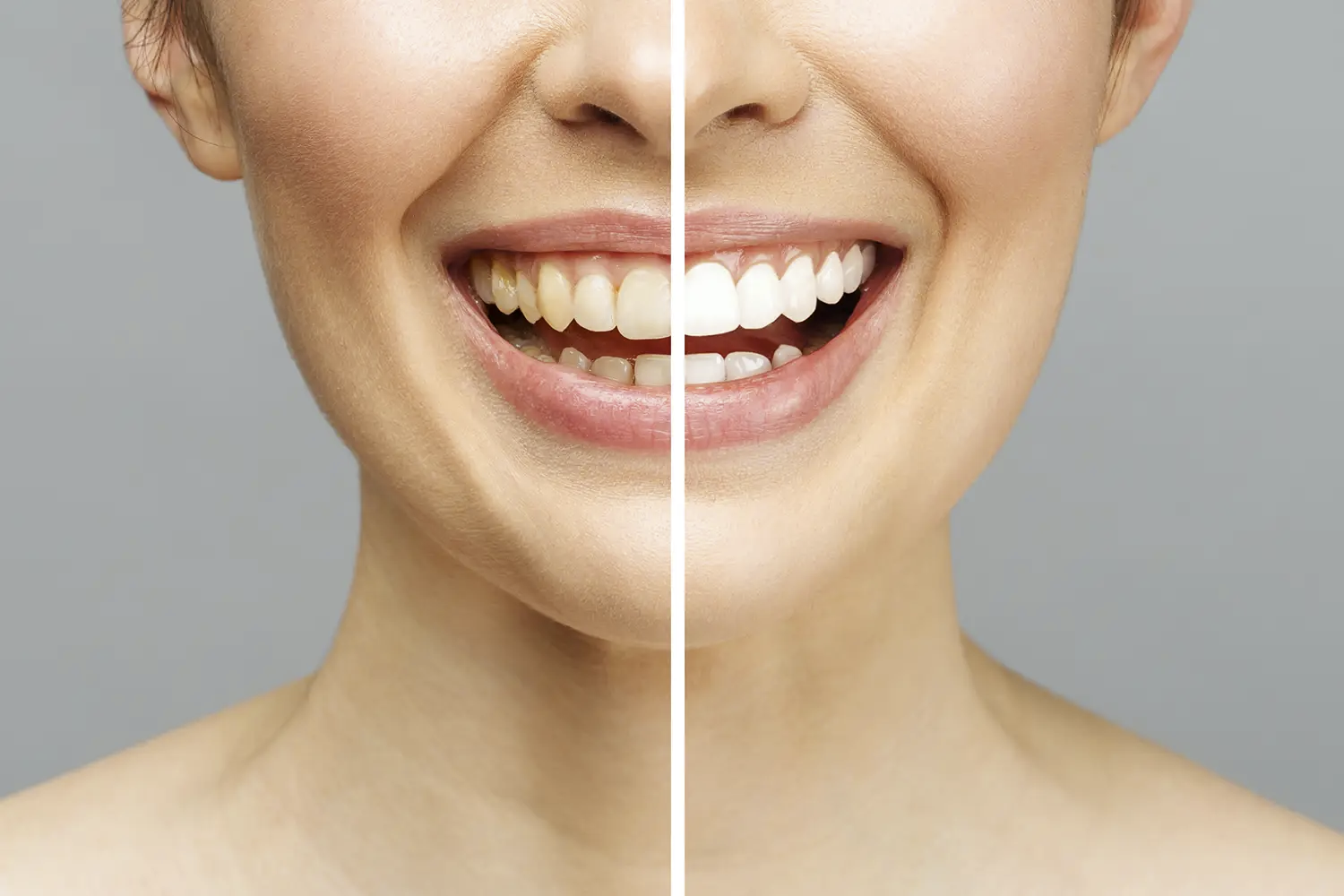 Pure Whitening